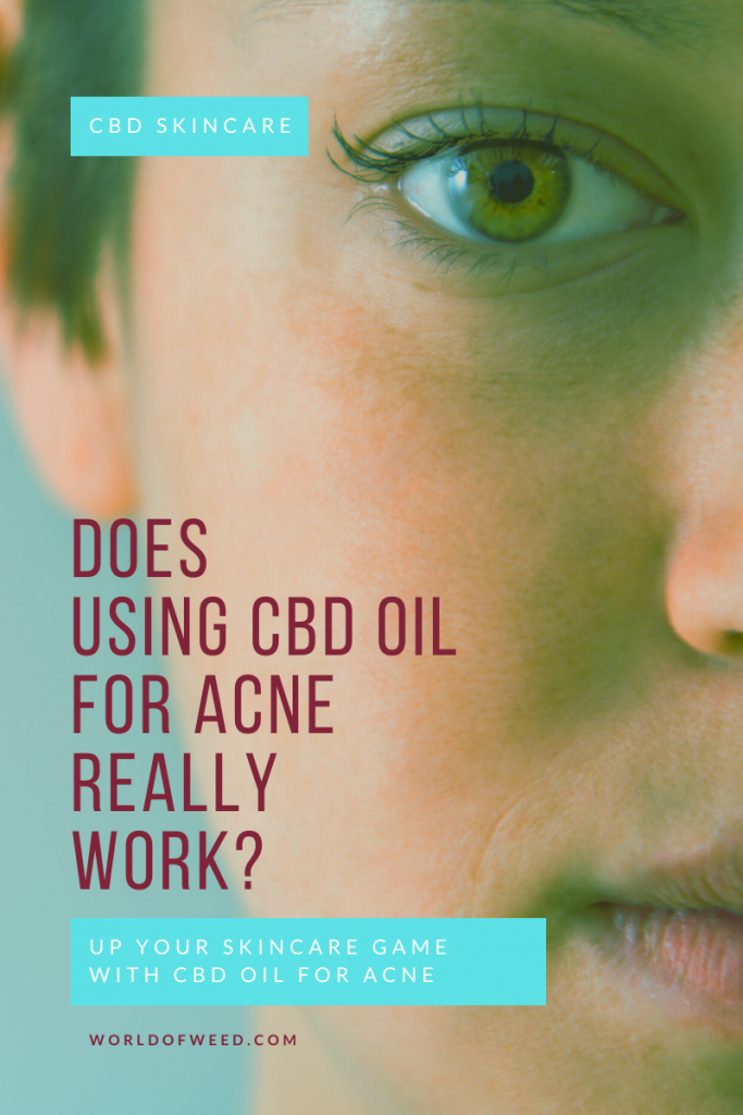 Using CBD oil for acne